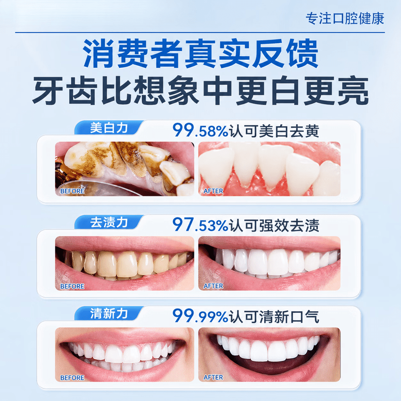 赫奈生物牙石溶解漱口水杀菌消炎除口臭牙结石牙龈出血清新口气 1瓶【轻度装】300ml*1 溶解浅层牙石 一漱去牙石 | 日常防结石 | 去烟茶咖啡渍