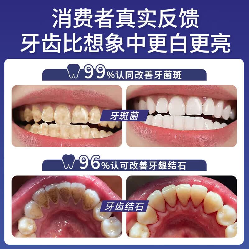 MANSCHKUI德国美白牙膏去黄去渍清新口气去烟渍儿童成年人含氟护龈金榜第一 2支周期装【家庭共享】 牙膏