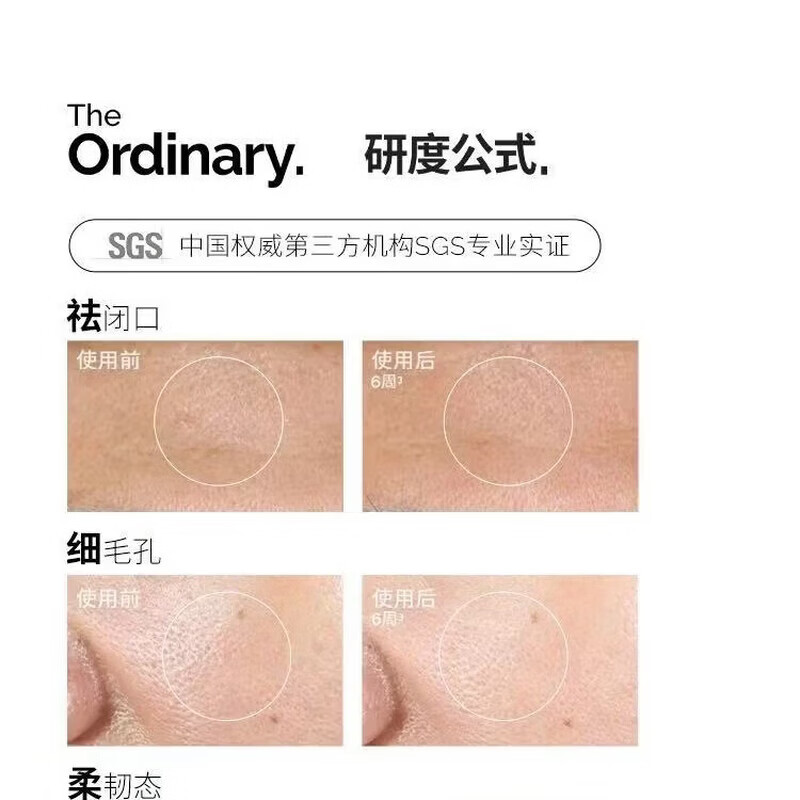 THE ORDINARY甘醇酸果酸水保湿精华爽肤水果酸祛痘温和研度公式去角质护肤品 THE ORDINARY 240ml果酸水*1瓶（提亮肤色 淡化痘印）