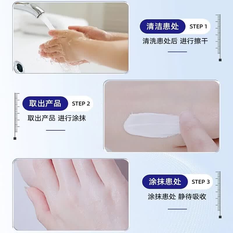 陈九玄皮下脂肪块疙瘩鼓包硬块肿块全身可用医用聚乙二醇护创敷料 1盒【体验装】贵在运费