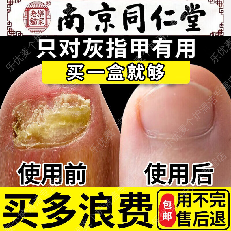 手机京东怎么看护足霜历史价格走势|护足霜价格走势