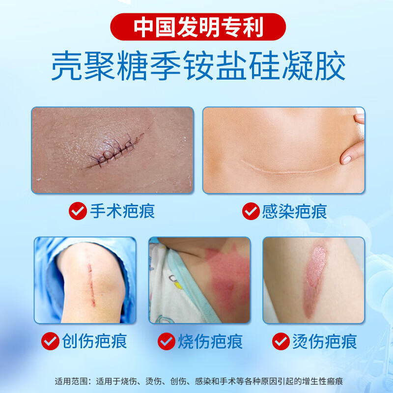 欣奕(3IN1)除疤®凝胶壳聚糖季铵盐硅凝胶医用祛疤膏改善疤痕增生修复 【10g装】壳聚糖季铵盐硅凝胶【赠品三选一】