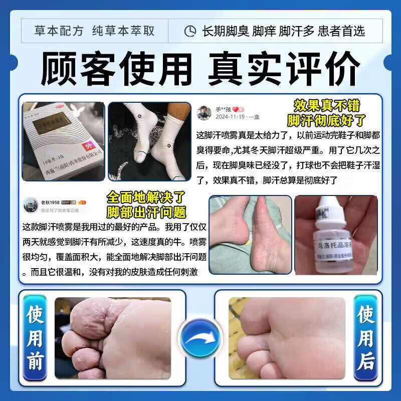 [西施兰夏露]乌洛托品溶液 40%*20ml 1盒装 汗脚止汗脚臭克星脚汗脚臭止汗喷雾除脚臭脚酸脚出汗气专用药止汗脚痒脱皮烂脚 脚底出汗