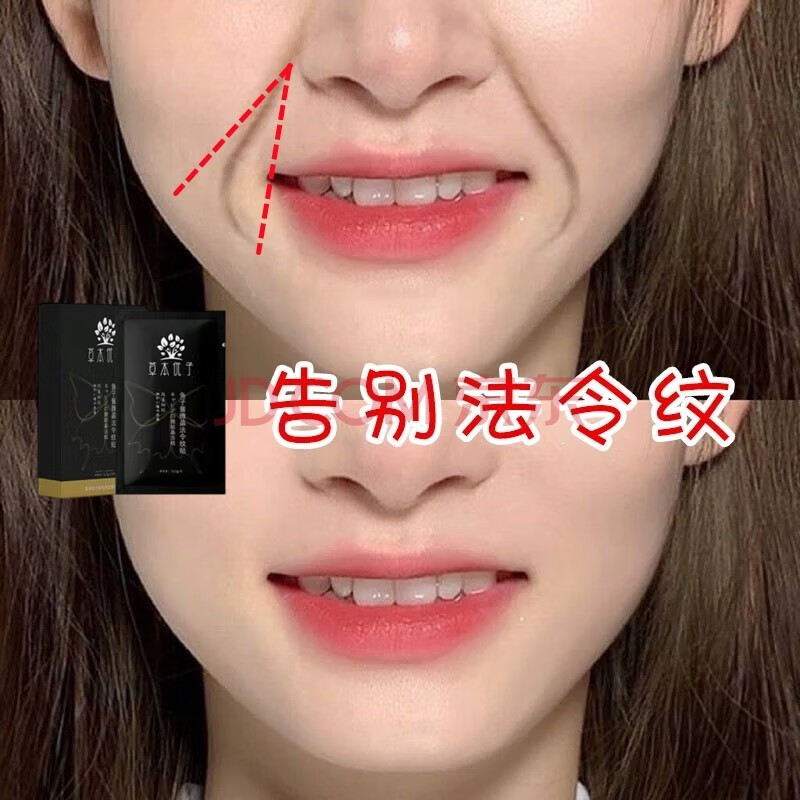 nhfouyou日本草本优子鱼子酱微晶法令纹贴提拉紧致淡化细纹嘴角纹八字