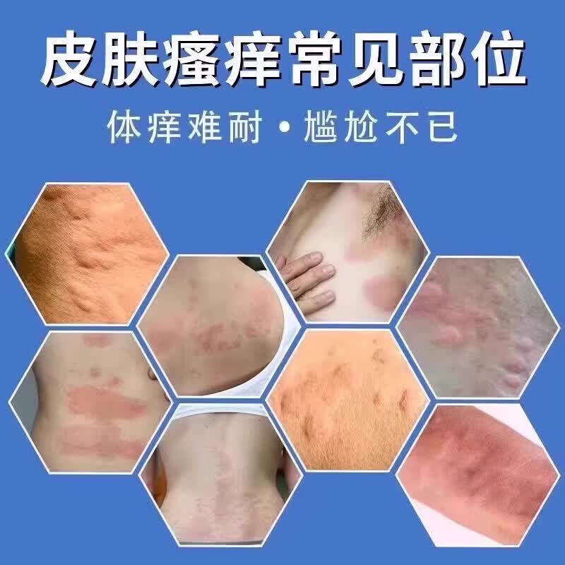 [济仁]百癣夏塔热片 0.31g*36片 5盒装 皮肤瘙痒中成药皮肤瘙痒止痒特新效药皮炎湿疹真菌感染期红疙瘩清除异常粘液质胆液质 越挠越痒 巩固装
