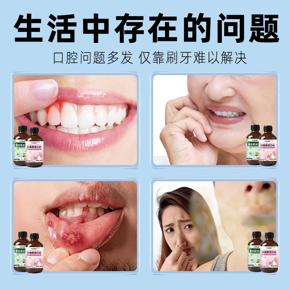 欧菲梵碘络酮漱口水清新口腔杀菌口腔护理清新持久多种味道 水蜜桃+薄荷味各2瓶（共4瓶）