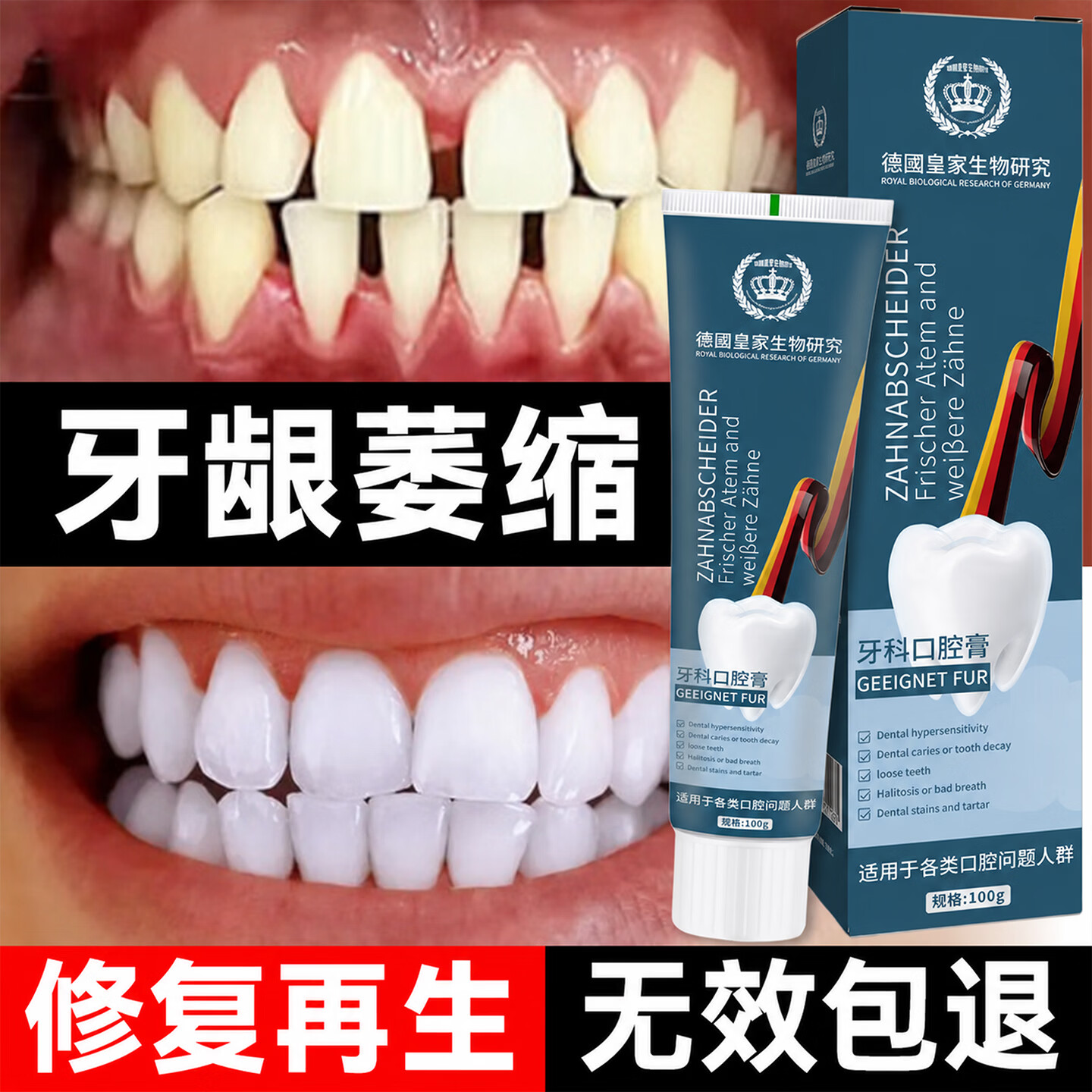 SOVIP德国牙膏护龈固齿牙龈I萎缩修复再I生牙根外露牙周I炎牙齿I松动 【牙龈养护体验装】1支