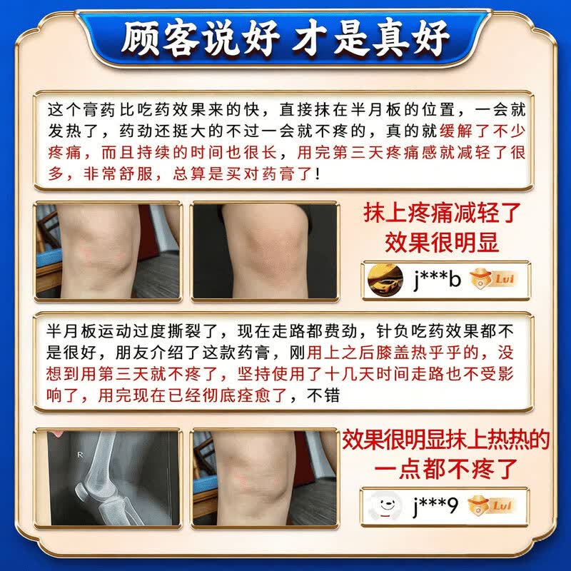 岩井昃弘膝盖疼痛专用膏药贴中老年半月板损伤修复药膝盖积液关节炎滑膜炎 特强效1盒【北京协和】可修复