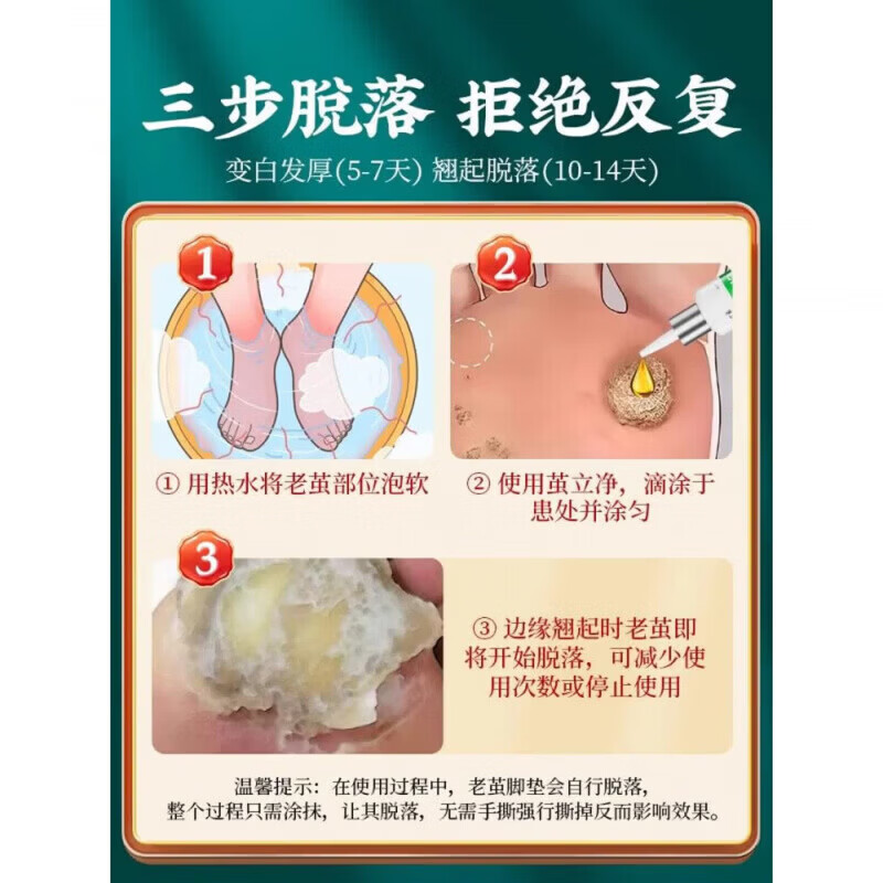 黄辅堂茧立净老茧子脚茧厚眼鸡草本萃取手足脚底板用正品 买五送五  到手10瓶 正品保障