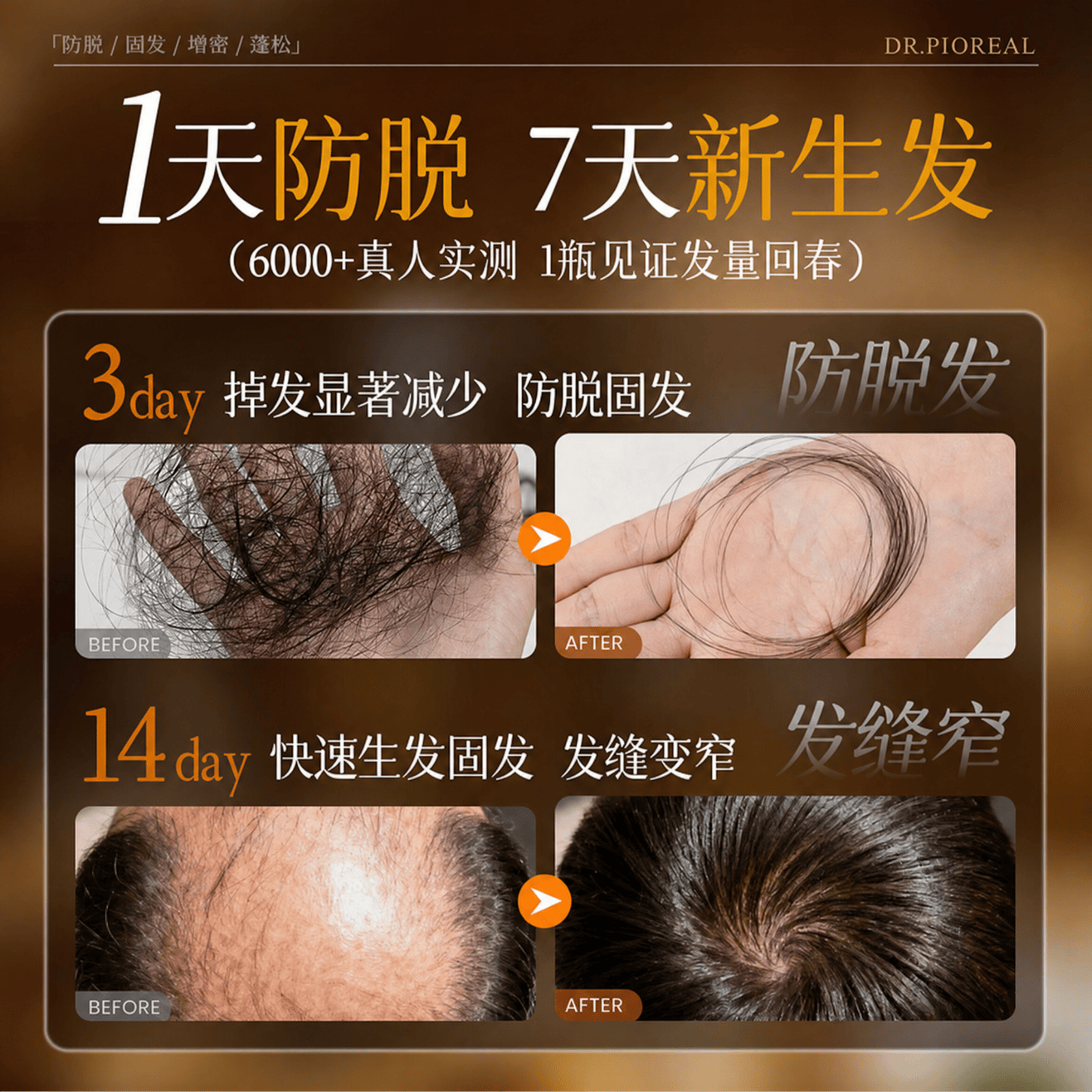 DR.JRAIOS瑞士品牌防脱育发液护固发头发生长发剂激活毛囊增密发头皮精华液 【药房热销同款】重度脱发止脱精华液 120ml*1支