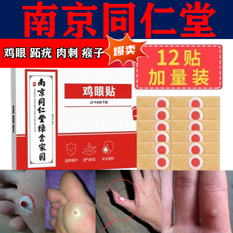 肉刺刺猴跖疣无痛i脱落足部脚底脚趾鸡眼专的用药鸡眼去除专的用药水