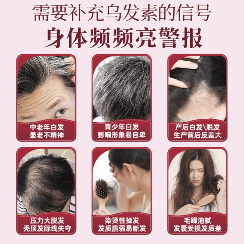DWDS卡西奈维生素b黑发官方正品乌发素改善白发掉发强健发根滋养毛囊 卡西奈 60片*3盒 正品