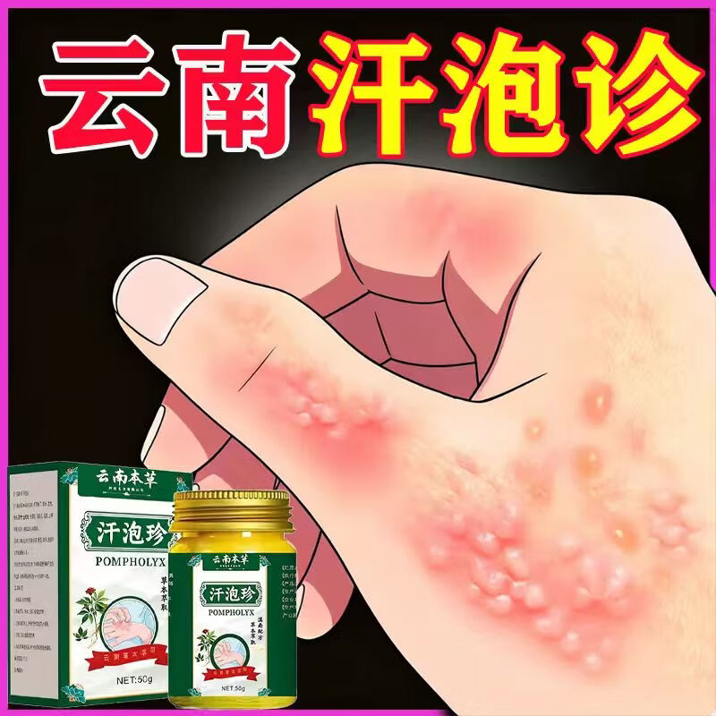 云南汗泡疹本草膏疱珍抑菌汗孢疹手上起小汗泡汗泡珍瘙痒抑菌膏 1盒*50g[初步效果】