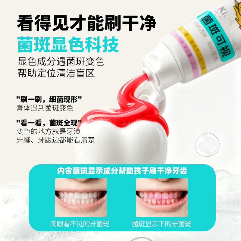 金口馨儿童牙膏防龋固齿氟钙双护3-12岁换牙期牙龈护理儿童口腔专用 菌斑可视 蜜桃味60g