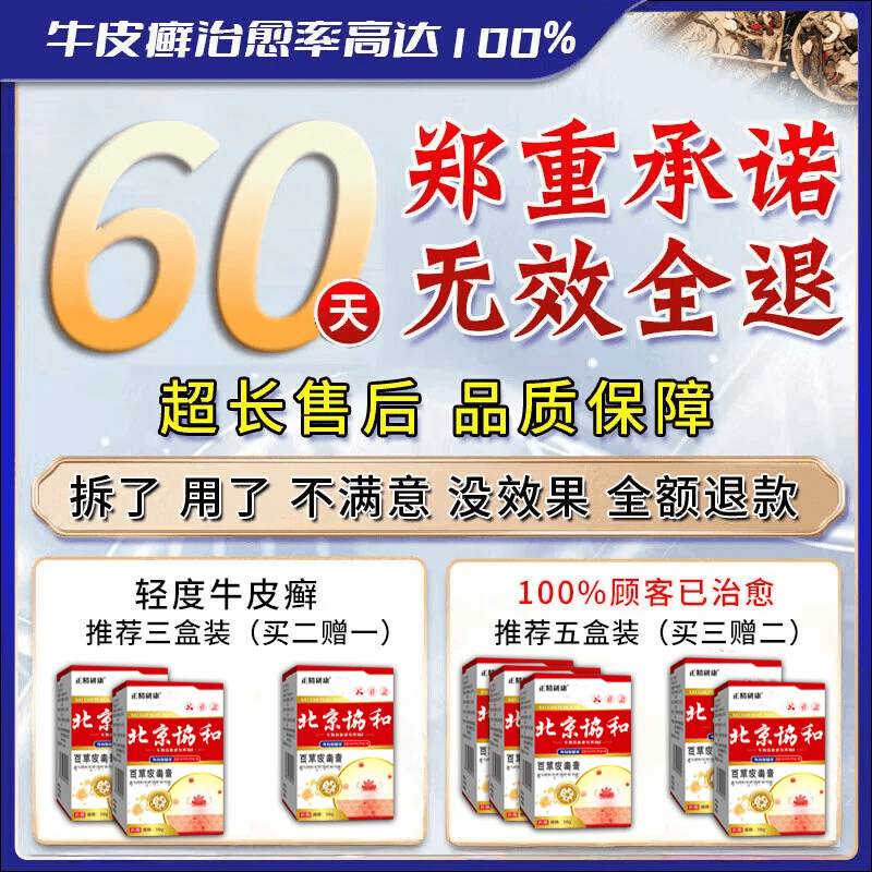 北京协和医学院牛皮癣断根药皮肤癣膏药真菌止痒抑菌皮肤顽固牛皮癣i药膏进口 特强效一盒【牛皮癣克星】 银屑病牛皮癣皮肤癣专用特强效膏