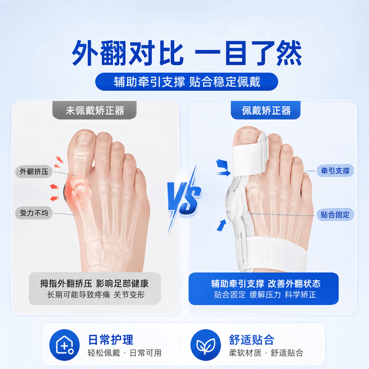 HKZA日本拇指外翻矫正器可穿鞋分趾器成人男女通用不伤脚骨大脚趾 加强1对+夜用1对 无痛矫正不伤骨 角度可调节