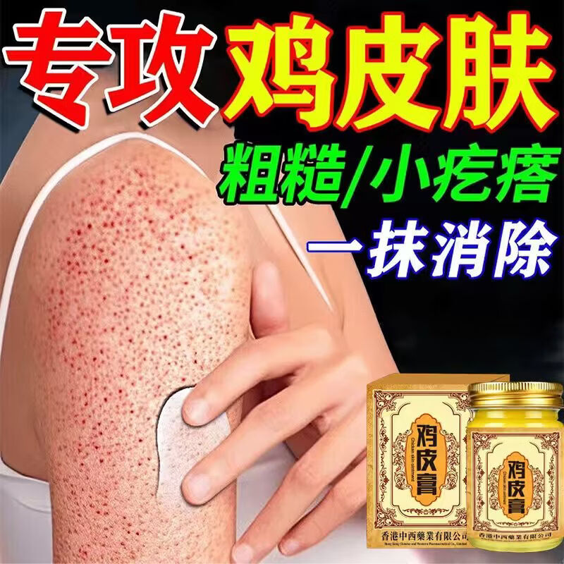 香港鸡皮肤疙瘩毛周角化症去除大腿胳膊手臂疙瘩鸡皮膏身体护理 【中度鸡皮】 50g 2瓶 润滑嫩肌肤