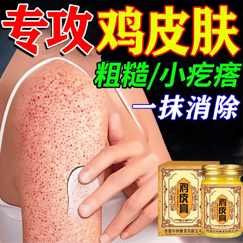 香港鸡皮肤疙瘩毛周角化症去除大腿胳膊手臂疙瘩鸡皮膏身体护理 【轻度鸡皮】 50g 1瓶 温和无刺激