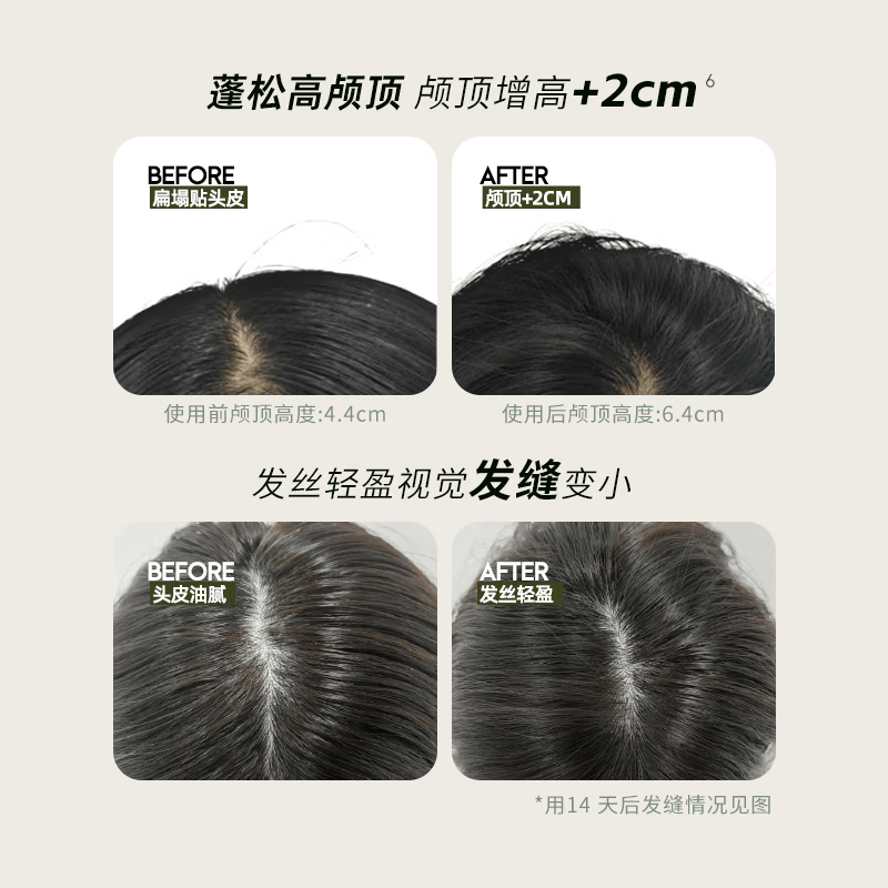 即沐蓬蓬免洗洗发水嘭嘭玻尿酸敏感肌可用控油高颅顶免洗 【特惠装】免洗蓬蓬露5ml*20支