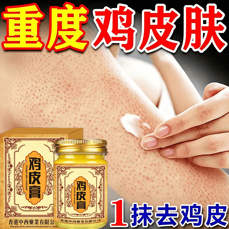 香港鸡皮肤疙瘩毛周角化症去除大腿胳膊手臂疙瘩鸡皮膏身体护理 【轻度鸡皮】 50g 1瓶 温和无刺激