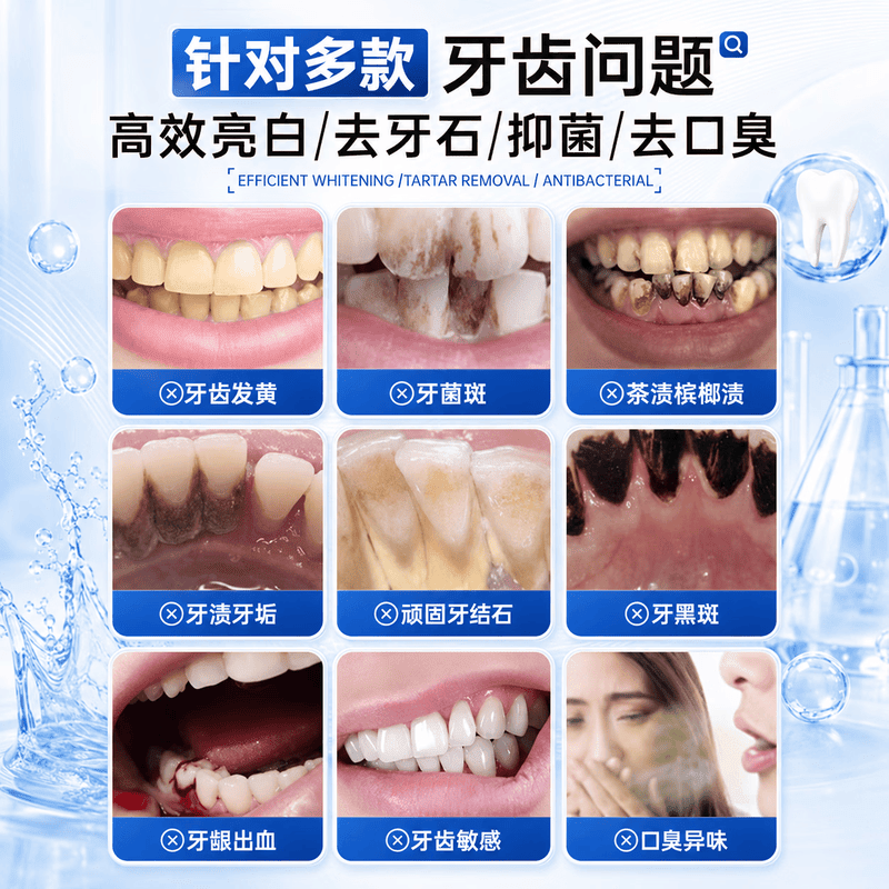 赫奈生物牙石溶解漱口水杀菌消炎除口臭牙结石牙龈出血清新口气 1瓶【轻度装】300ml*1 溶解浅层牙石 一漱去牙石 | 日常防结石 | 去烟茶咖啡渍