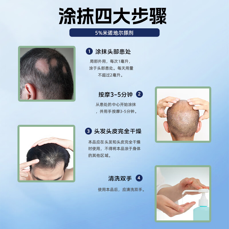[安之秀]米诺地尔搽剂 60ml*2瓶 1盒装 5% 60ml*2瓶1盒装 米诺地尔搽剂男女士专用生发防脱育发治疗脱发斑秃
