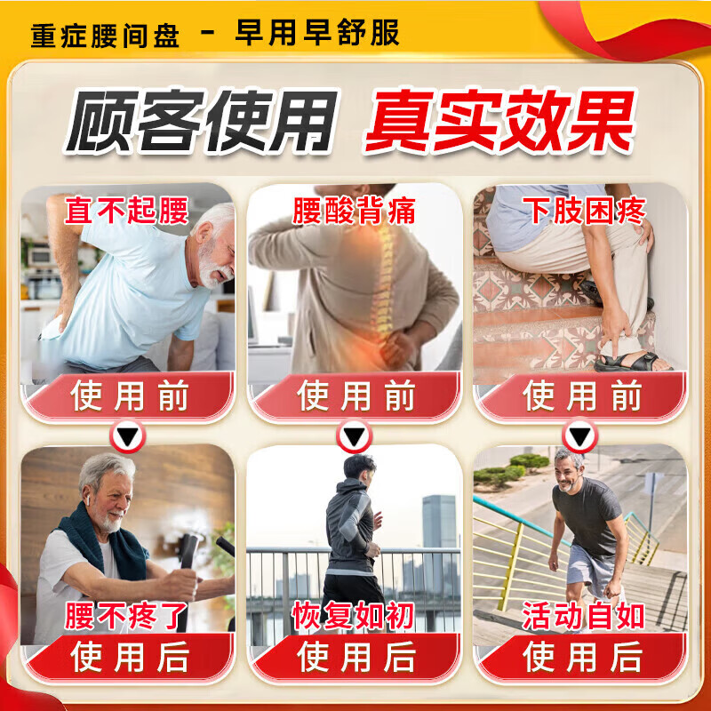 日本科技腰间盘突出100%特效膏腰肌劳损压迫神经腰疼腰痛贴腰椎 特效腰椎贴【一盒装】10贴 腰椎间盘突出压迫神经腰疼屁股疼