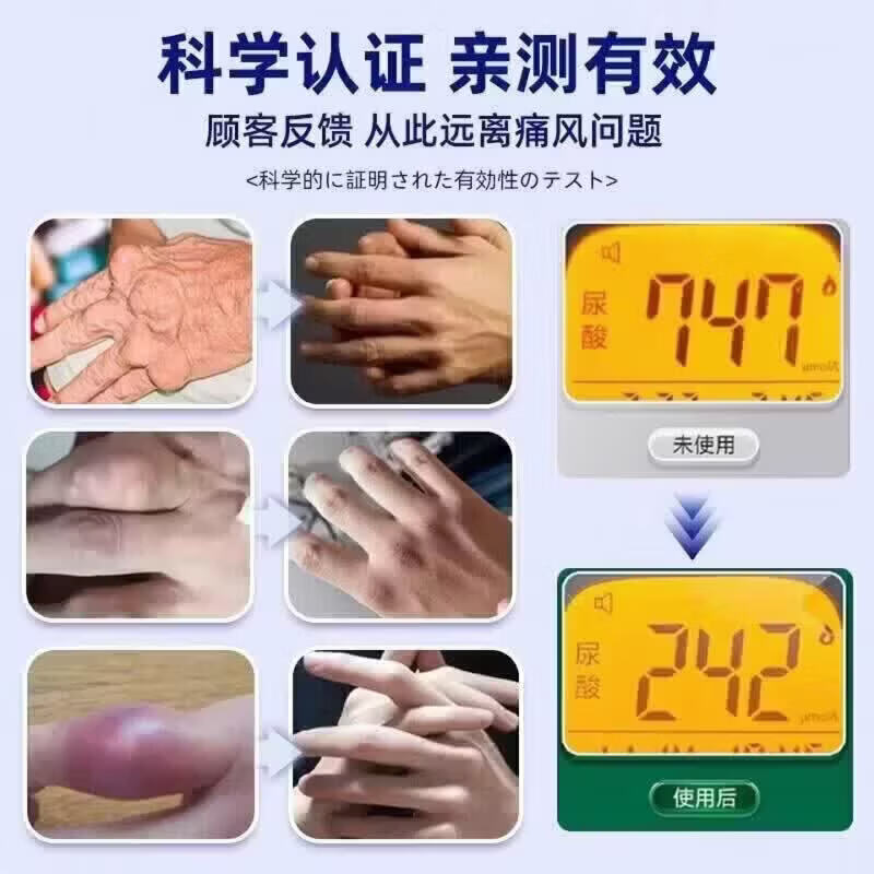 仲夫子硝酸片进口痛风专研肩颈腰腿膝盖疼痛痛风性关骨不适消肿 两盒装【超值周期大部分选择】