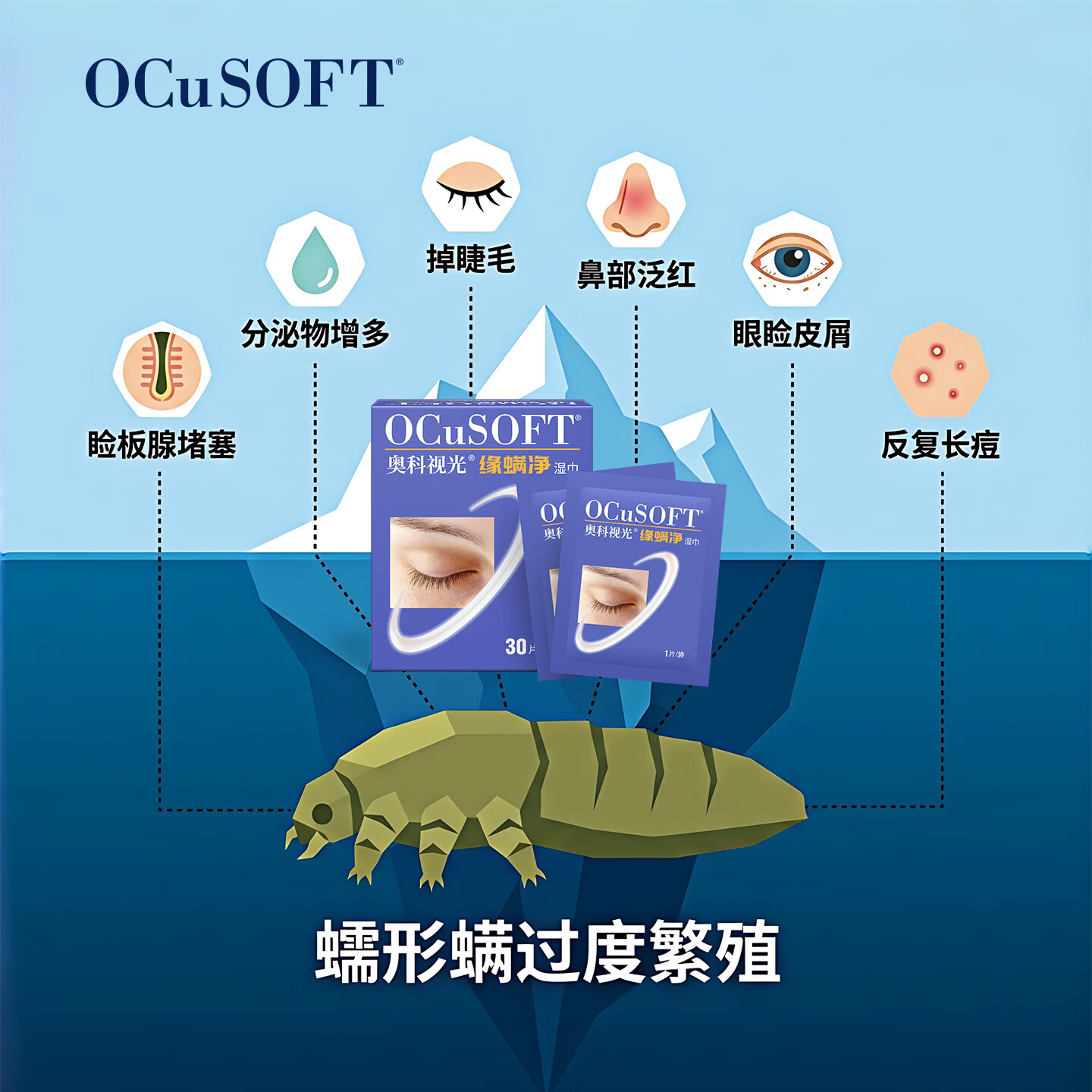 OCuSOFT【眼部除螨】缘螨净茶树油湿巾 掉睫毛专用除螨虫眼贴 专利配方 缘螨净湿巾1盒:30片