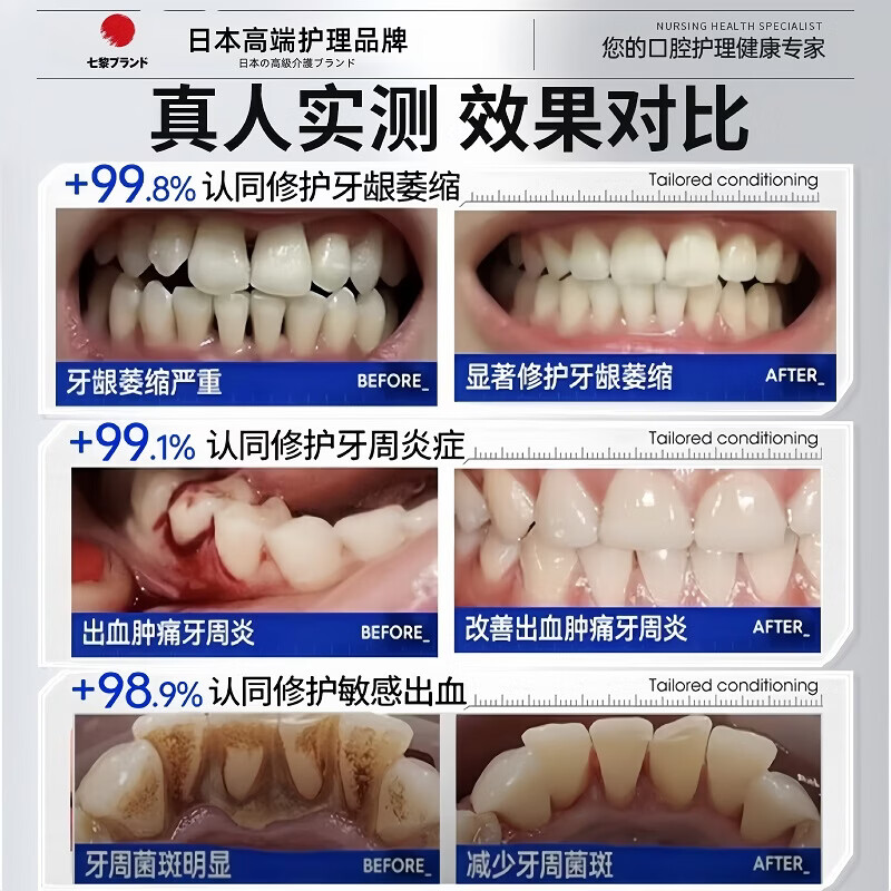 七黎牙龈萎縮专用牙膏护龈固齿修复再生牙周根外露牙齿松炎动正品旗舰 2盒半价【牙齿敏感 牙龈I萎缩再生肿痛出血】无效包退