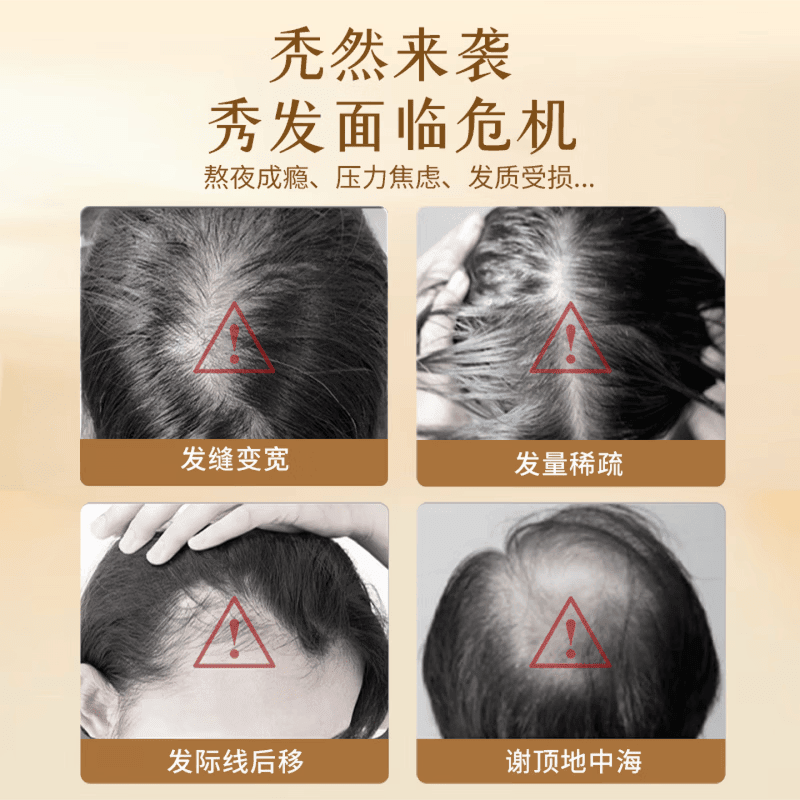 DWDS卡西奈维生素b黑发官方正品乌发素改善白发掉发强健发根滋养毛囊 卡西奈 60片*3盒 正品