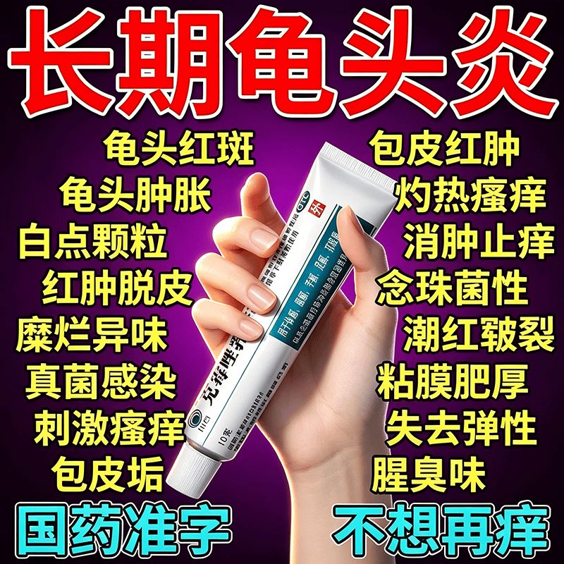 [川石]克霉唑乳膏 男性真菌感染龟头炎白垢豆腐渣男士专用膏药红肿瘙痒丘疹红点白点念珠菌性霉菌男科用药 1%*10g 1盒装 【快速缓解私处瘙痒红肿】