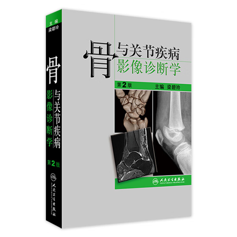 骨与关节疾病影像诊断学 第2版 梁碧玲 主编 9787117230384 2016年9月参考书 人