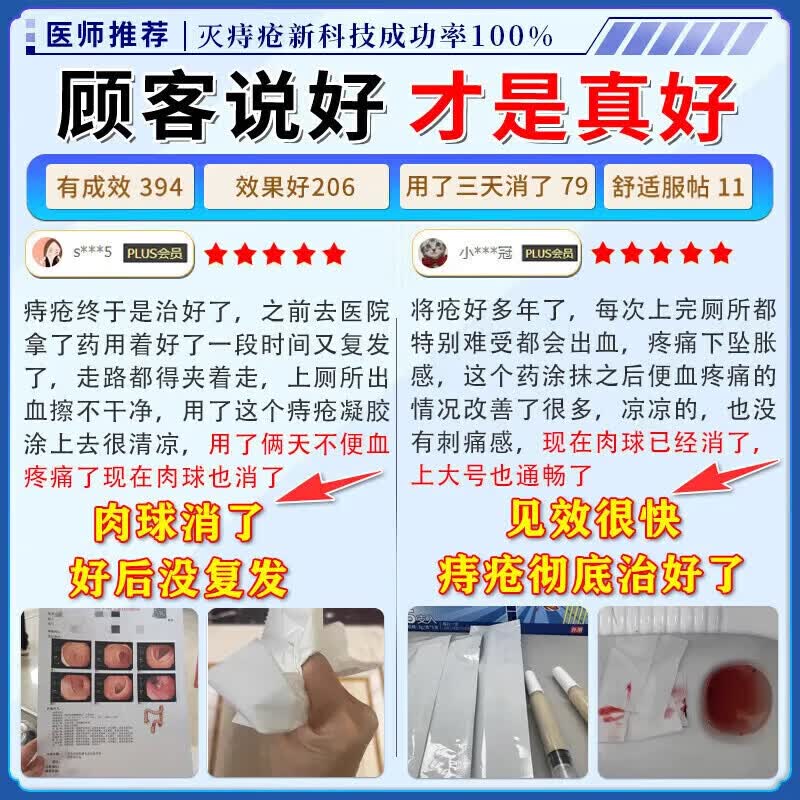德国原装进口痔疮i膏痔疮凝胶专用去肉球根断专用特强效药痔治根 100%特效:1盒[德国进口】 消痣苍膏痔根断正品痔疮凝胶去肉球内外混合痔疮药专用