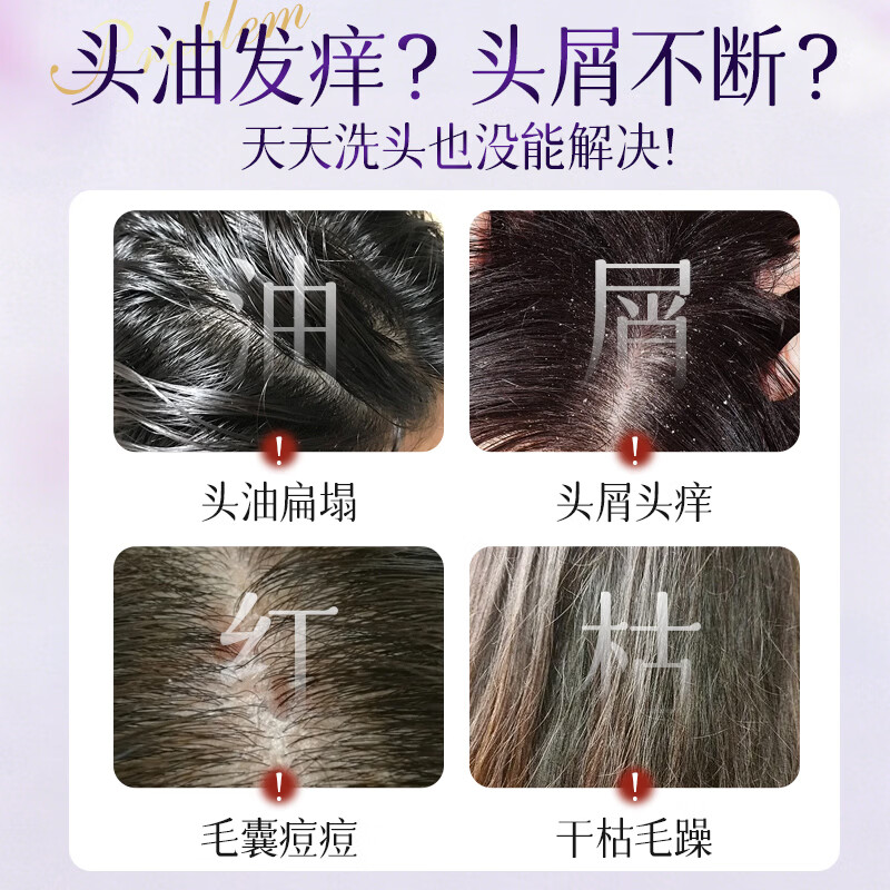浅香(ASAKA)洗发水沐浴露套装 氨基酸控油肽清爽蓬松去屑洗发乳烫染修护保湿 控油洗发水600g+沐浴露600g+顺滑膏260g