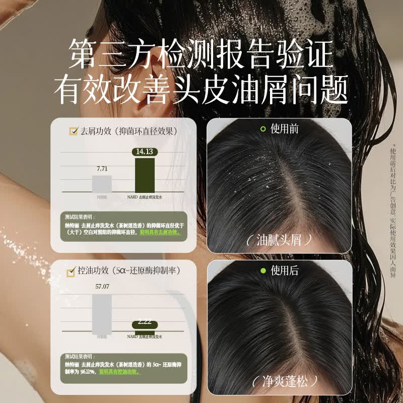 BOUQUET GARNI NARD去屑止痒洗发水控油清洁清爽茶树迷迭香【韩国原装进口】 去屑止痒洗发水（茶树迷迭香）500ml