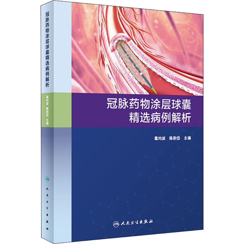 冠脉药物涂层球囊精选病例解析