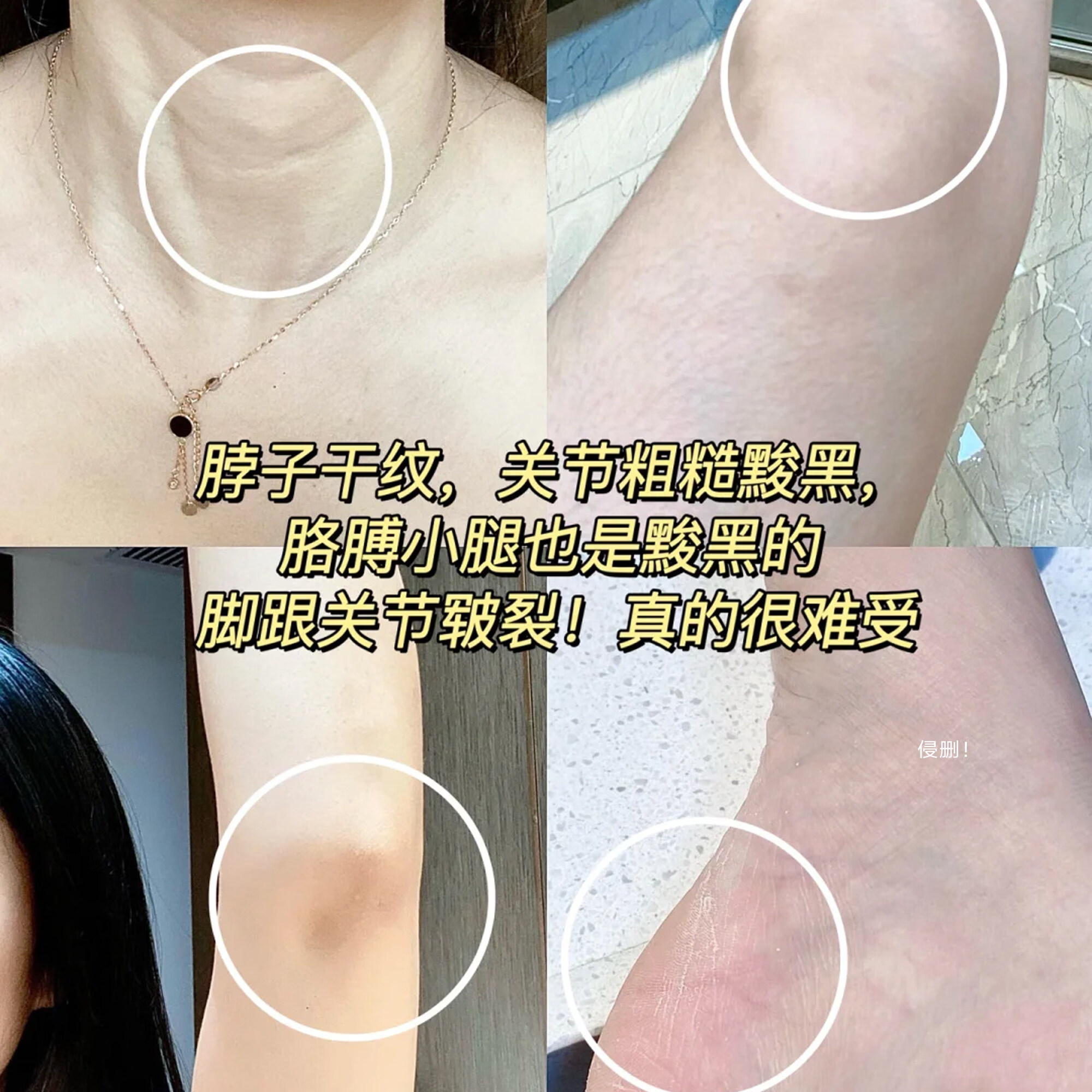 丝塔芙(Cetaphil)保湿霜大白罐润肤乳身体乳550g 118ml倍润牛油果乳液