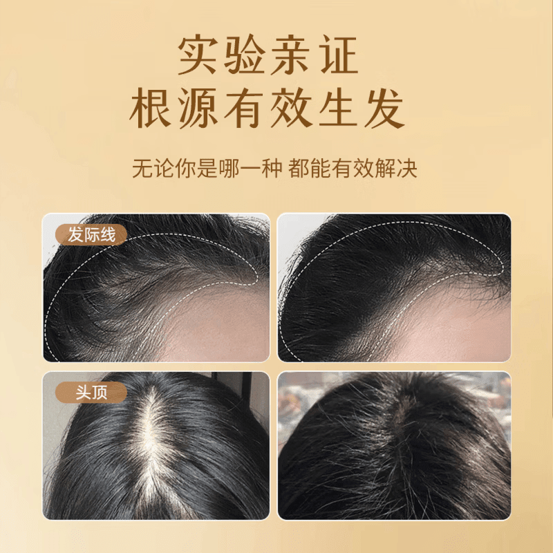 DWDS卡西奈维生素b黑发官方正品乌发素改善白发掉发强健发根滋养毛囊 卡西奈 60片*3盒 正品