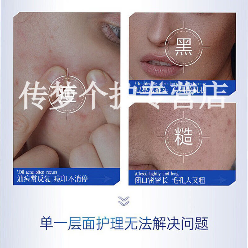 vuir医用凝胶毛孔粗大淡化痘印痘痘闭口淡法令纹医美术后修复 1盒【见效装】 【品牌直售】