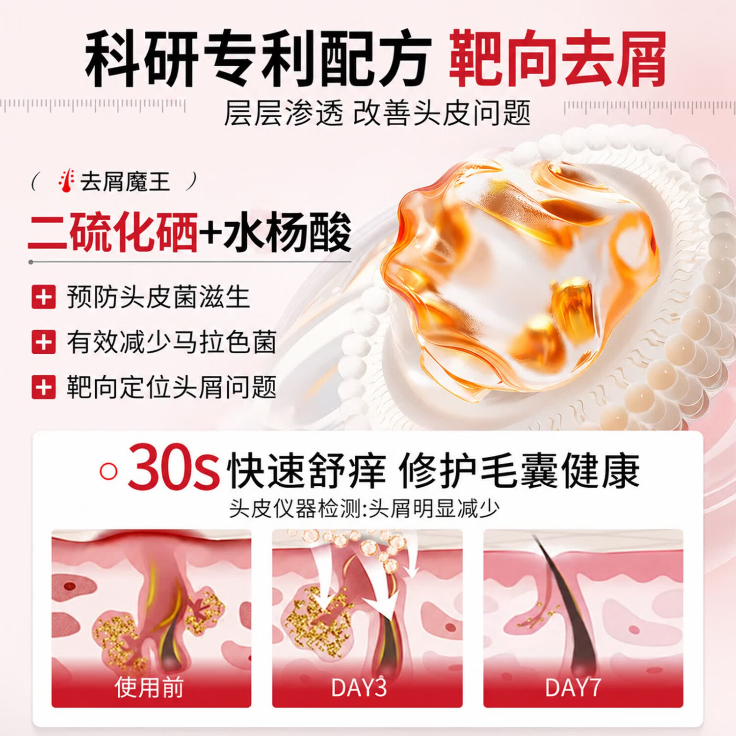 初蔓二硫化硒洗发水男女士专用去屑止痒控油持久蓬松洗头膏露榜金第1 【医研配比】二硫化硒洗发水600ml*1