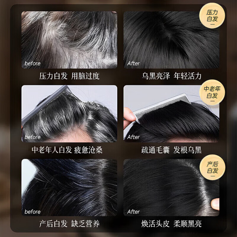 漫描洗发水男士清爽控油蓬松防脱去屑何首乌植物育发滋养发根 5瓶【囤货优选 巩固不返白】 清爽控油蓬松防脱去屑洗发水