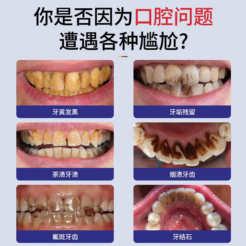 MANSCHKUI德国美白牙膏去黄去渍清新口气去烟渍儿童成年人含氟护龈金榜第一 2支周期装【家庭共享】 牙膏