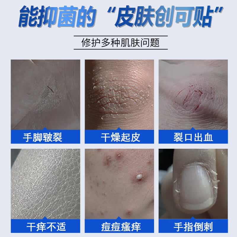 步长水润抑菌霜 手纹干裂粗糙死皮倒刺修护嫩肤补水保湿护手霜通用 【全家适用】25g/支*4