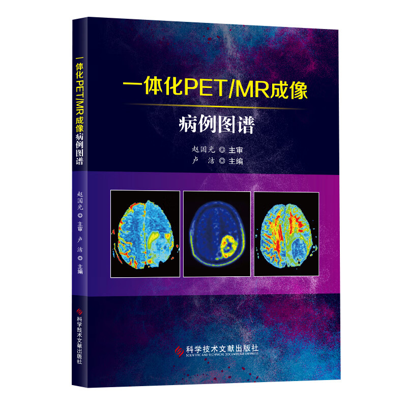 一体化petmr成像病例图谱 计算机x线扫描体层摄影 核磁共 振成象影象