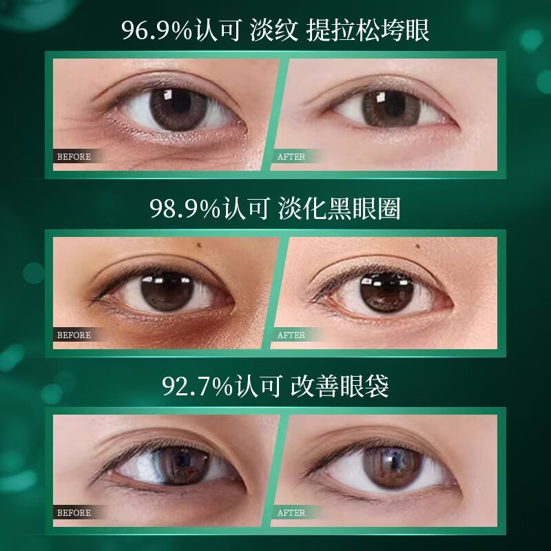 SKALL中药草本人参虫草眼霜紧致抗皱逆颜淡化黑眼圈熬夜细纹大眼袋提拉 【买二送一】到手3瓶【解决各种眼部问题】