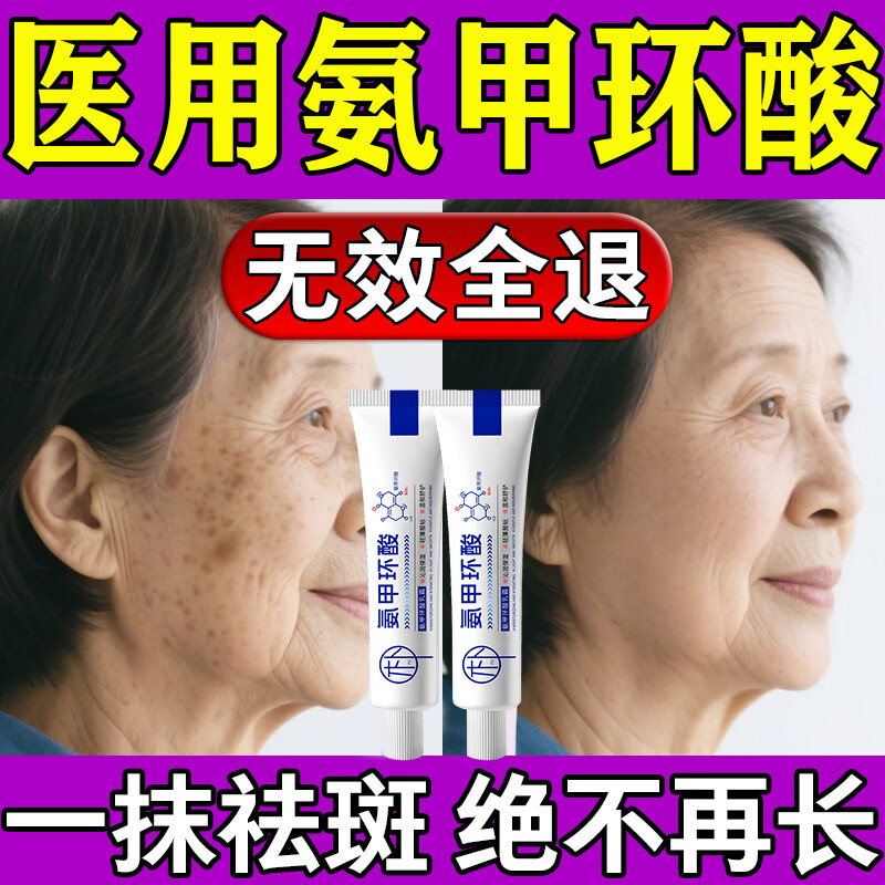 植朴氨甲环酸乳膏祛斑医用国药准字美白祛斑霜去黄褐斑氨甲环酸软膏 买二送一【500%包祛斑】无效退 氨甲环酸湿敷液5%浓度凝胶精华液
