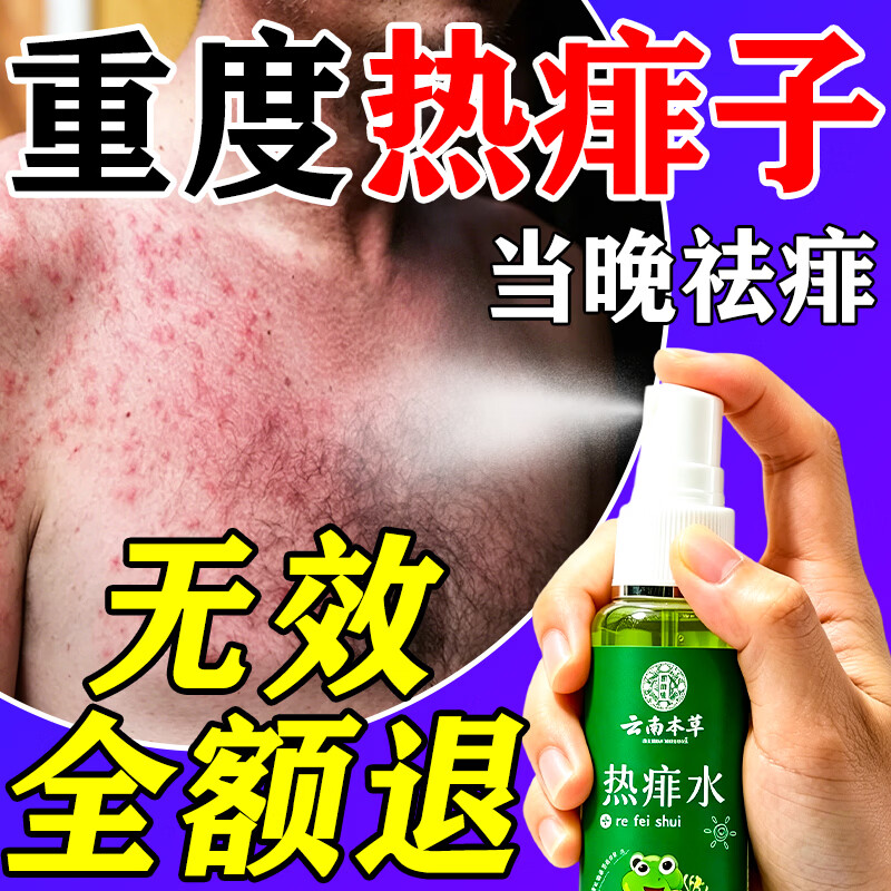 云南本草痱子水祛痱止痒祛热抑菌成人婴幼儿童通用金银花热痱水专用喷雾剂 1瓶装【体验装】祛痱止痒专用