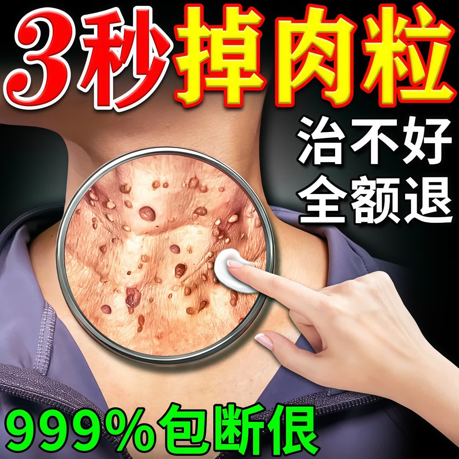 七黎【一洗就掉】祛疣皂瘊尤皂猴子小肉粒痘痘粉刺清洁去尤香皂全身 买2送1【强效去疣】78%客户选择更划算
