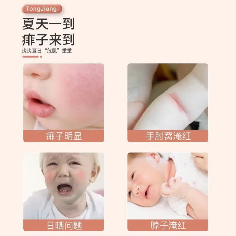 童将氨基酸婴儿爽身露 液体爽身粉婴儿痱子粉 宝宝痱子水儿童润肤水 【渠道专享】爽身露